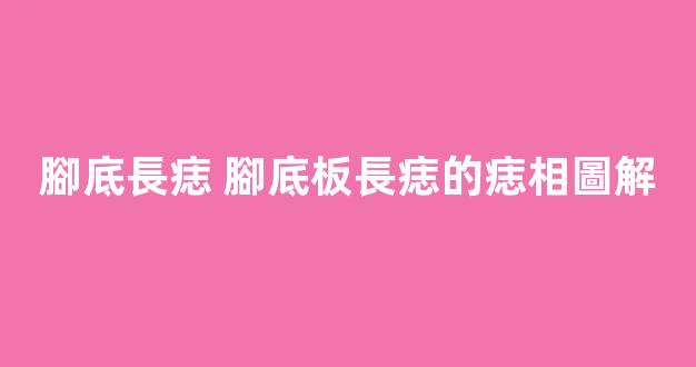 腳底長痣 腳底板長痣的痣相圖解